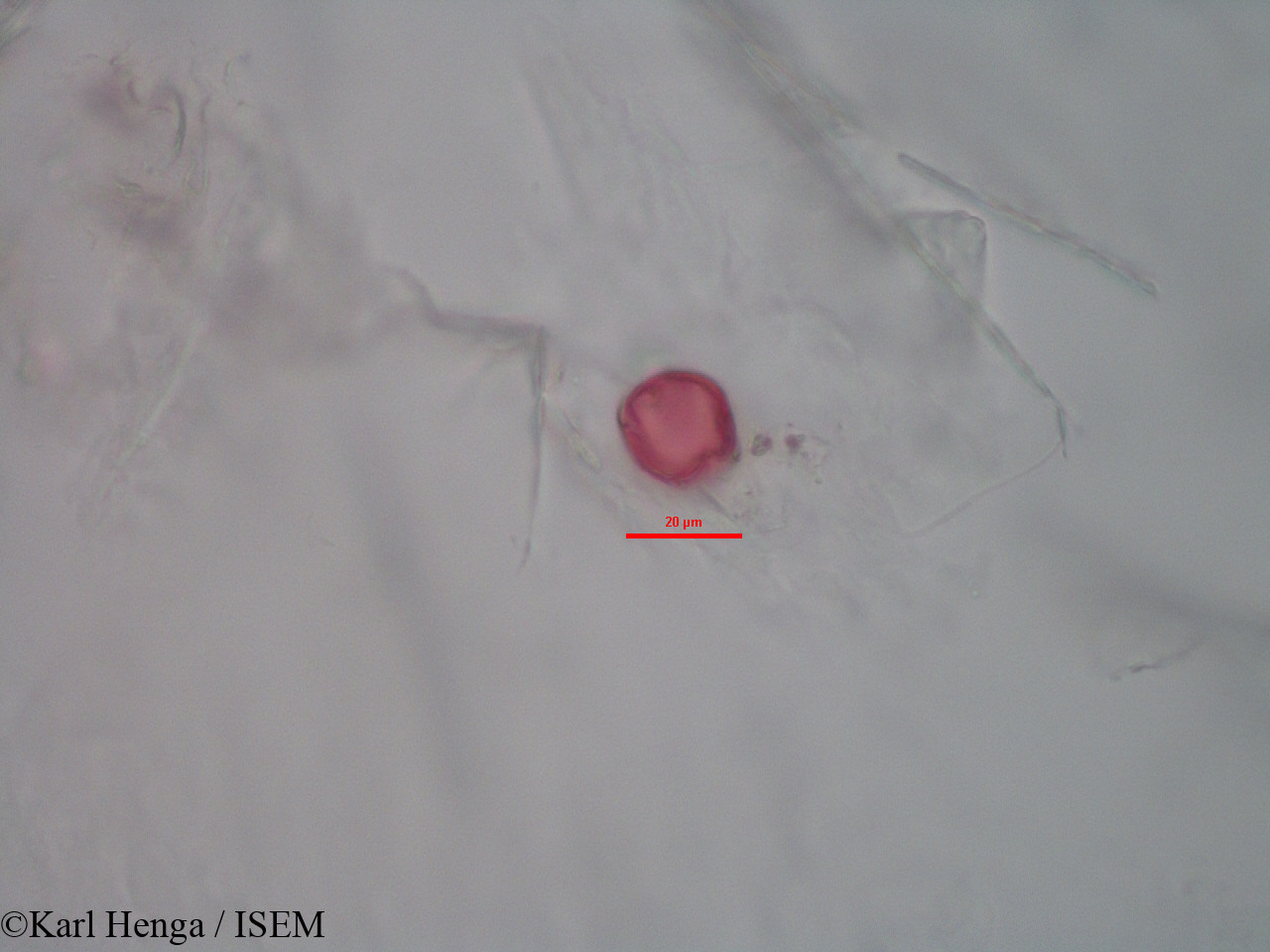 Karl.Henga/Kyllinga_polyphylla_28180/Kyllinga_polyphylla_28180_0005(copy).jpg