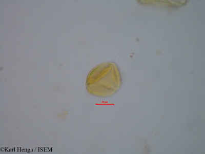 Karl.Henga/Lavigeria_macrocarpa_14828/Lavigeria_macrocarpa_14828_0001(copy)_thumb.jpg