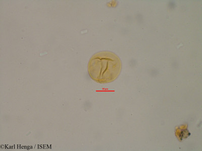 Karl.Henga/Leptactina_hexamera_18410/Leptactina_hexamera_18410_0001(copy)_thumb.jpg