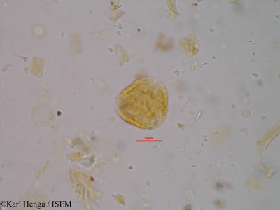 Karl.Henga/Magnistipula_zenkeri_699/Magnistipula_zenkeri_699_0001(copy)_thumb.jpg