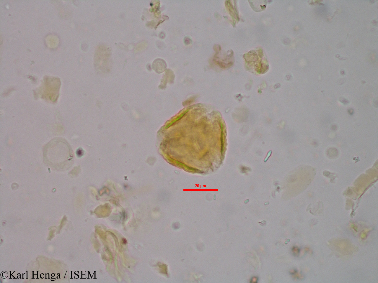 Karl.Henga/Magnistipula_zenkeri_699/Magnistipula_zenkeri_699_0009(copy).jpg