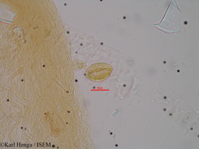 Karl.Henga/Maprounea_membranacea_21240/Maprounea_membranacea_21240_0001(copy)_thumb.jpg