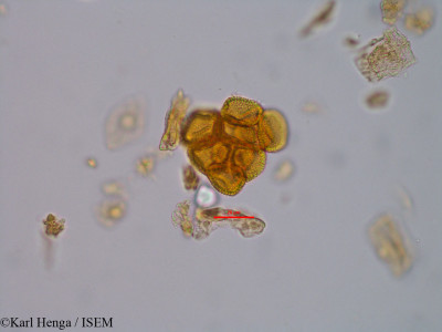 Karl.Henga/Massularia_acuminata_46801/Massularia_acuminata_46801_0001(copy)_thumb.jpg