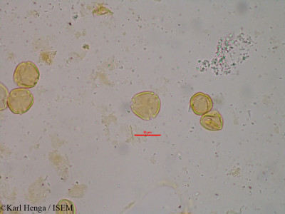 Karl.Henga/Mitragyna_stipulosa_19470/Mitragyna_stipulosa_19470_0001(copy)_thumb.jpg