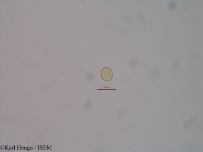 Karl.Henga/Myrianthus_preussii_40134/Myrianthus_preussii_40134_0001(copy)_thumb.jpg