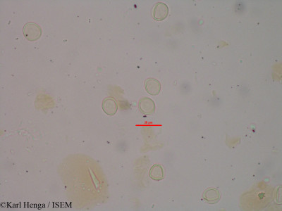 Karl.Henga/Myrianthus_serratus_539/Myrianthus_serratus_539_0001(copy)_thumb.jpg