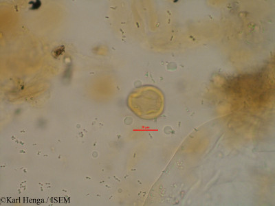 Karl.Henga/Omphalocarpum_anocentrum_23081/Omphalocarpum_anocentrum_23081_0001(copy)_thumb.jpg