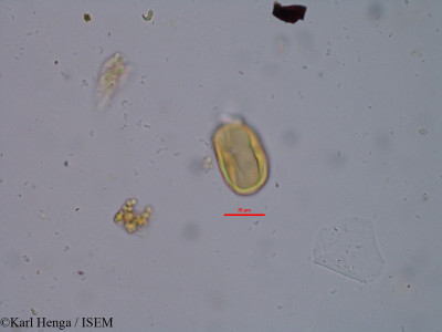 Karl.Henga/Pachystela_brevipes_34815/Pachystela_brevipes_34815_0001(copy)_thumb.jpg