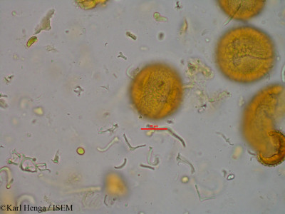 Karl.Henga/Paropsia_grewioides_45745/Paropsia_grewioides_45745_0001(copy)_thumb.jpg