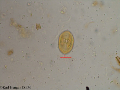 Karl.Henga/Pavetta_hispidula_9690/Pavetta_hispidula_9690_0001(copy)_thumb.jpg