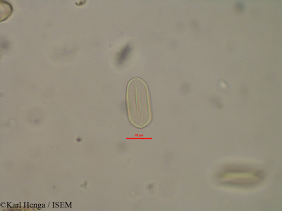 Karl.Henga/Podococcus_barteri_32110/Podococcus_barteri_32110_0001(copy)_thumb.jpg