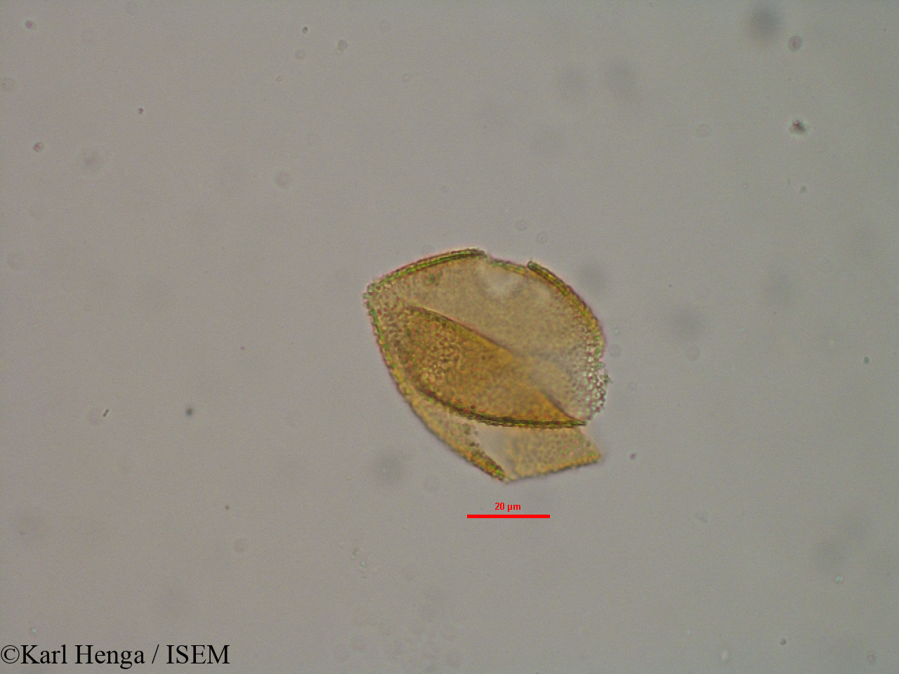Karl.Henga/Psychotria_vogeliana_19584/Psychotria_vogeliana_19584_0001(copy).jpg