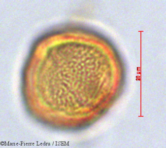 Marie-Pierre.Ledru/Schefflera_lasiogyne_29048/Schefflera_lasiogyne_29048_0001(copy)_thumb.jpg