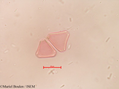 Muriel.Boulen/Roupala_loxensis_39410/Roupala_loxensis_39410_0001(copy)_thumb.jpg