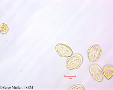 Serge.Muller/Comarum_palustre_27546/Comarum_palustre_27546_0001(copy)_thumb.jpg