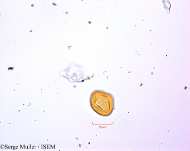 Serge.Muller/Potentilla_erecta_47370/Potentilla_erecta_47370_0001(copy)_thumb.jpg