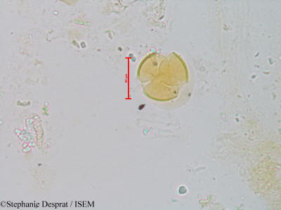 Stephanie.Desprat/Bhesa_paniculata_22864/Bhesa_paniculata_22864_0001(copy)_thumb.jpg