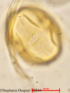 Stephanie.Desprat/Garuga_pinnata_9971/Garuga_pinnata_9971_0001(copy)_thumb.jpg