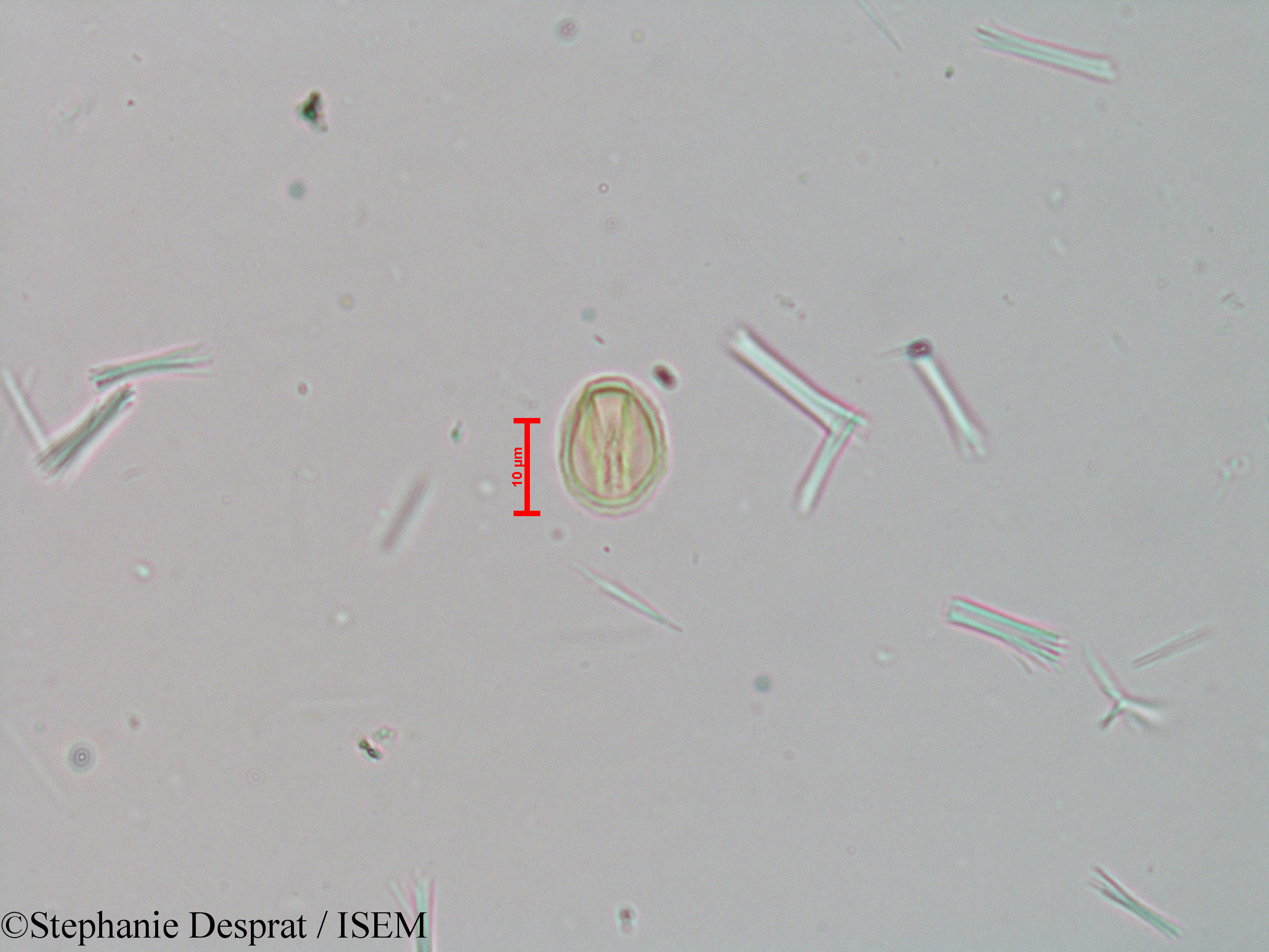 Stephanie.Desprat/Tetrameles_nudiflora_23982/Tetrameles_nudiflora_23982_0004(copy).jpg