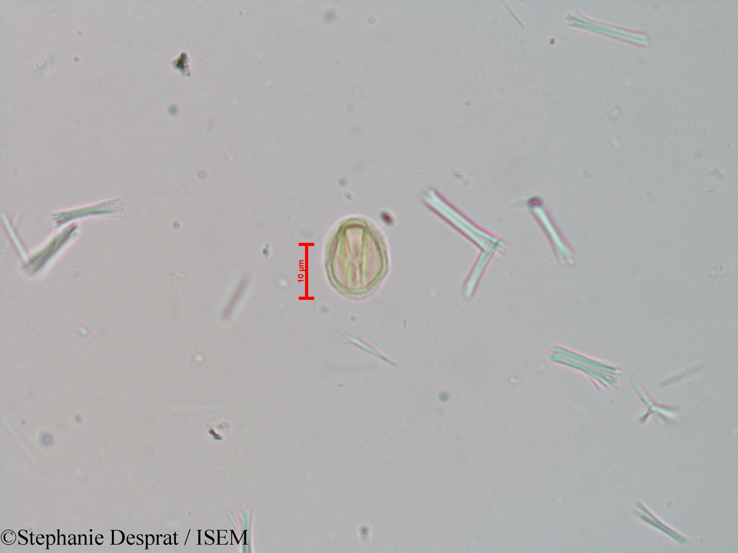Stephanie.Desprat/Tetrameles_nudiflora_23982/Tetrameles_nudiflora_23982_0005(copy).jpg