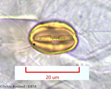 Acridocarpus excelsus - lame n° 1128