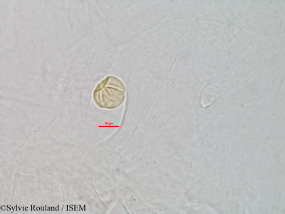 Sylvie.Rouland/Adenoplea_sinuata_3202/Adenoplea_sinuata_3202_0001(copy)_thumb.jpg