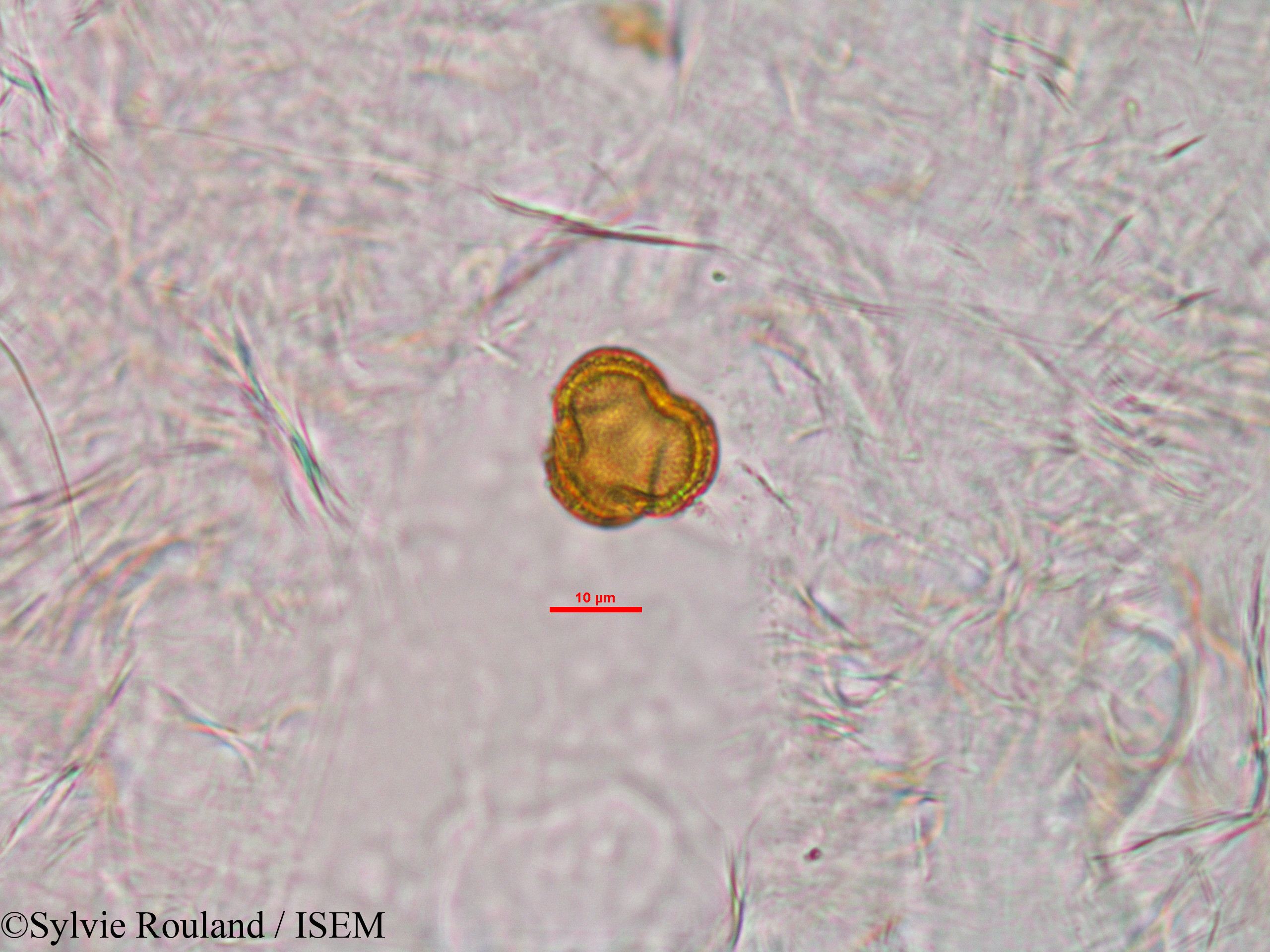Sylvie.Rouland/Anthostema_madagascariense_33929/Anthostema_madagascariense_33929_0003(copy).jpg