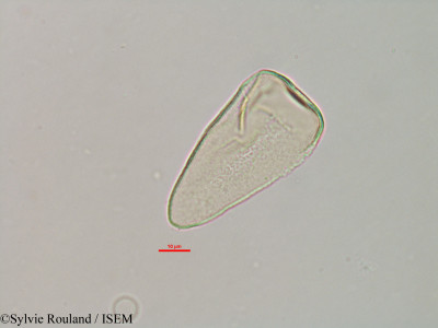 Sylvie.Rouland/Asterochaete_glomerata_7229/Asterochaete_glomerata_7229_0001(copy)_thumb.jpg