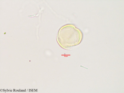 Asteropeia multiflora - lame n° 3496