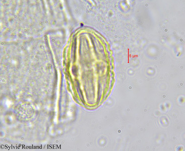 Sylvie.Rouland/Austropeucedanum_oreopansii_578/Austropeucedanum_oreopansii_578_0001(copy)_thumb.jpg
