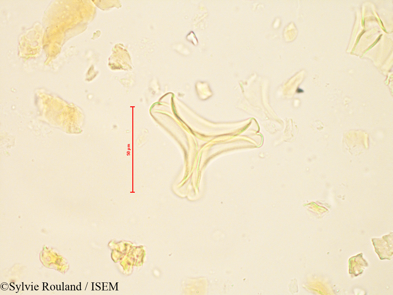 Sylvie.Rouland/Bakerella_gonoclada_4880/Bakerella_gonoclada_4880_0001(copy).jpg