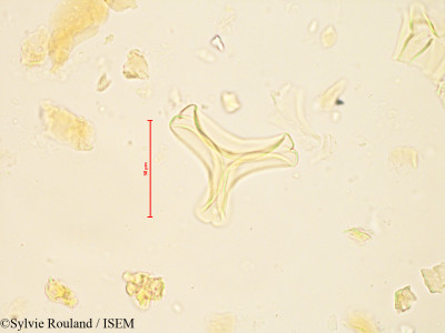 Sylvie.Rouland/Bakerella_gonoclada_4880/Bakerella_gonoclada_4880_0001(copy)_thumb.jpg