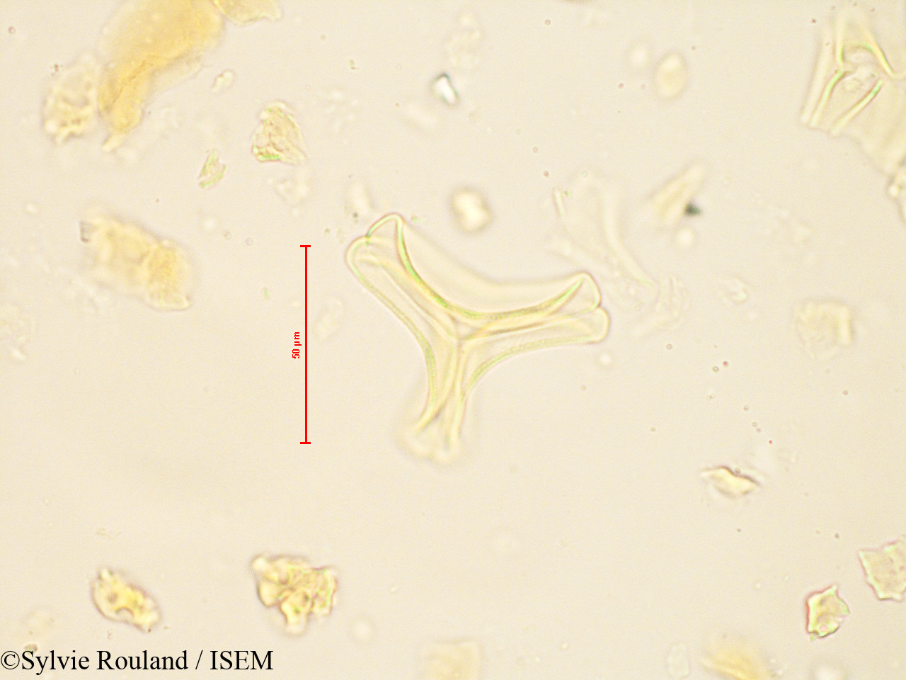 Sylvie.Rouland/Bakerella_gonoclada_4880/Bakerella_gonoclada_4880_0002(copy).jpg