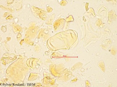 Bakerella gonoclada - lame n° 4880