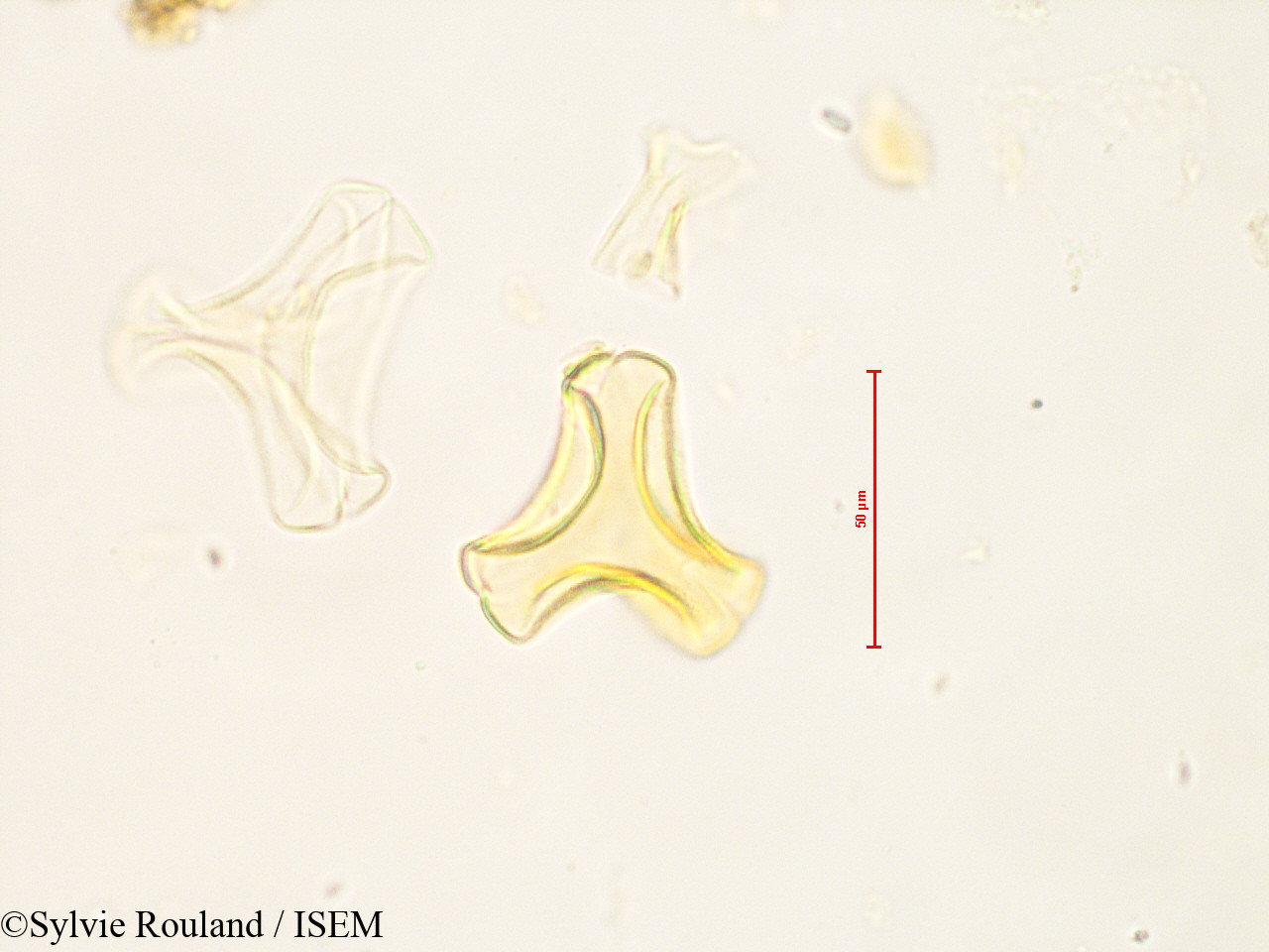 Sylvie.Rouland/Bakerella_microcuspis_4883/Bakerella_microcuspis_4883_0001(copy).jpg