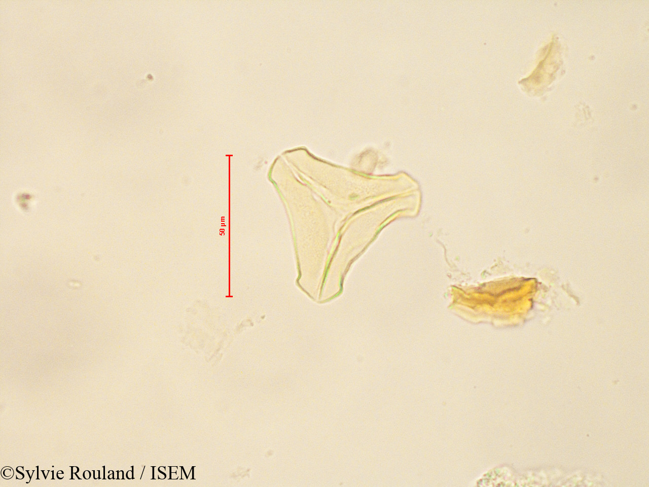 Sylvie.Rouland/Bakerella_microcuspis_4883/Bakerella_microcuspis_4883_0003(copy).jpg