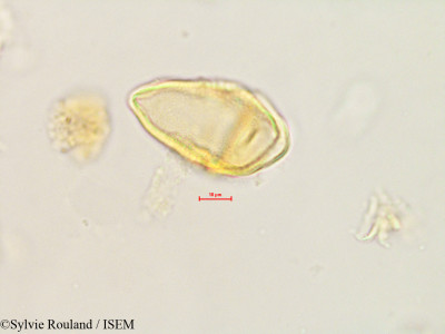 Bakerella tandrokensis - lame n° 4885