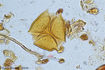 Sylvie.Rouland/Bauhinia_candida_5026/Bauhinia_candida_5026_0001(copy)_thumb.jpg