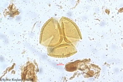 Bauhinia monandra - lame n° 5256