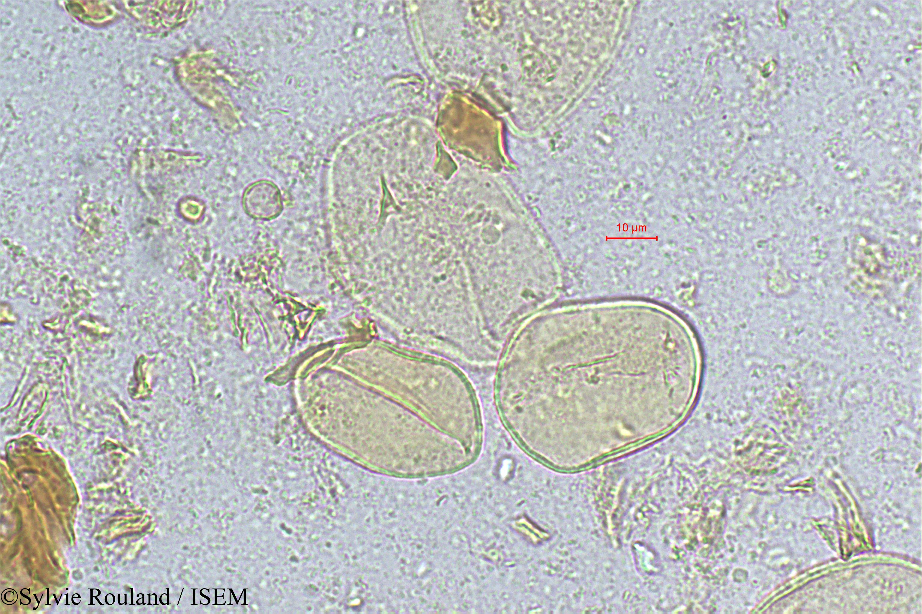 Sylvie.Rouland/Beccariophoenix_madagascariensis_317/Beccariophoenix_madagascariensis_317_0001(copy).jpg