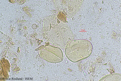 Beccariophoenix madagascariensis - lame n° 317
