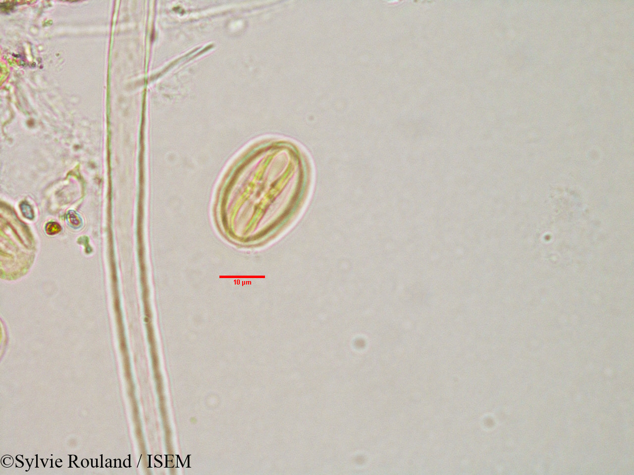 Sylvie.Rouland/Bivinia_jaubertii_3184/Bivinia_jaubertii_3184_0001(copy).jpg