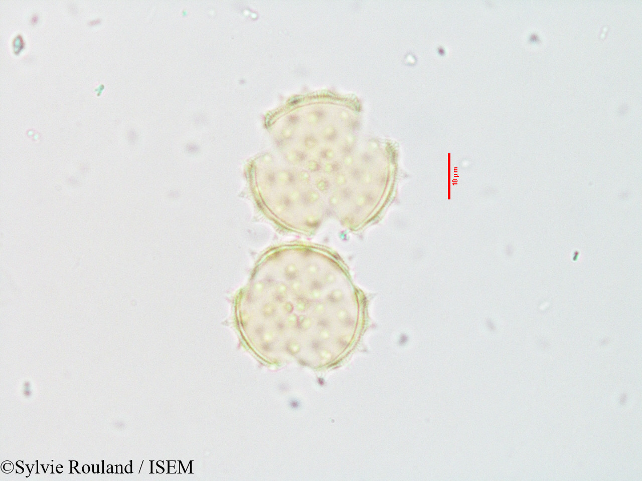 Sylvie.Rouland/Blepharispermum_zanguebaricum_3543/Blepharispermum_zanguebaricum_3543_0001(copy).jpg