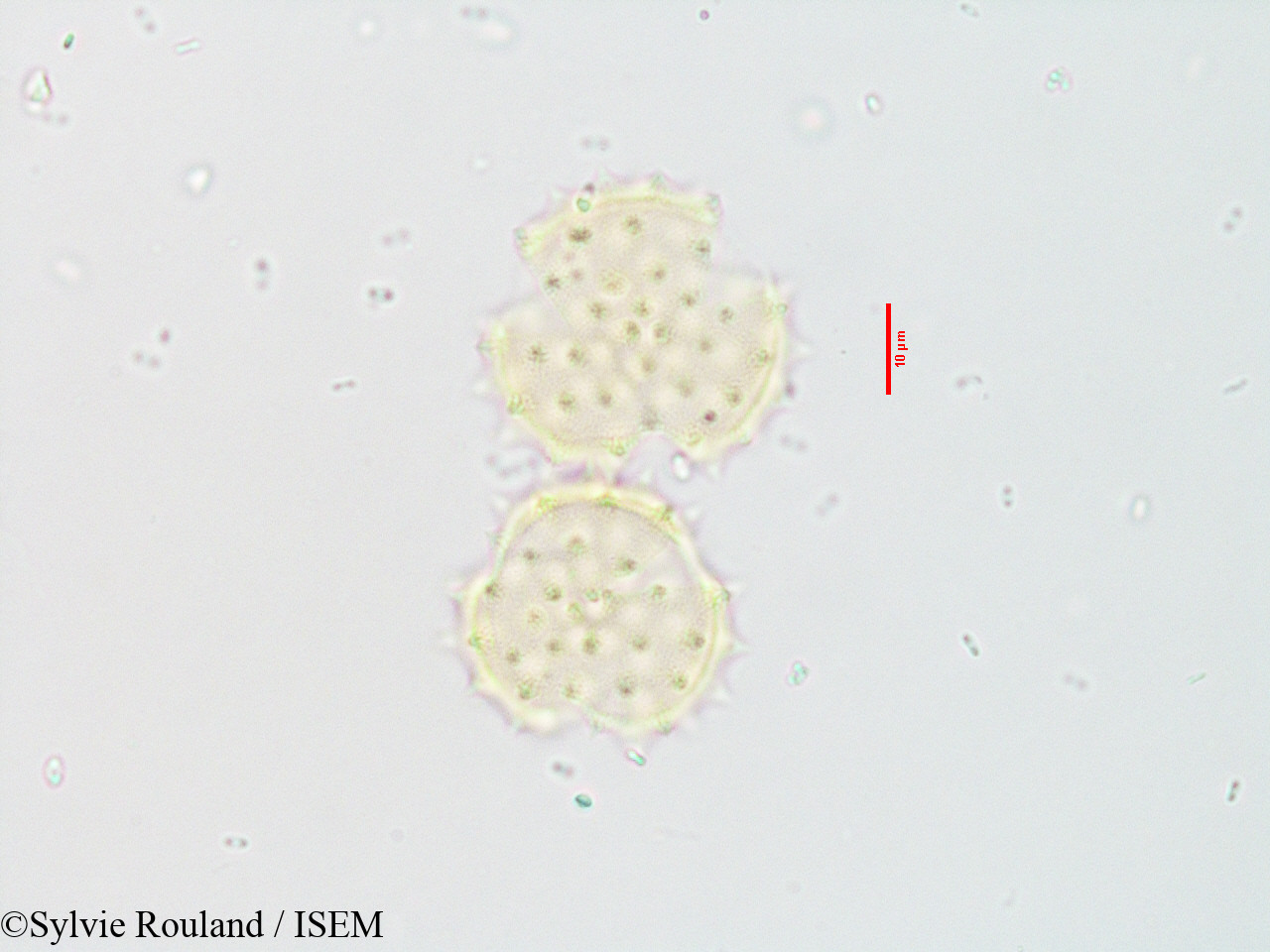 Sylvie.Rouland/Blepharispermum_zanguebaricum_3543/Blepharispermum_zanguebaricum_3543_0002(copy).jpg