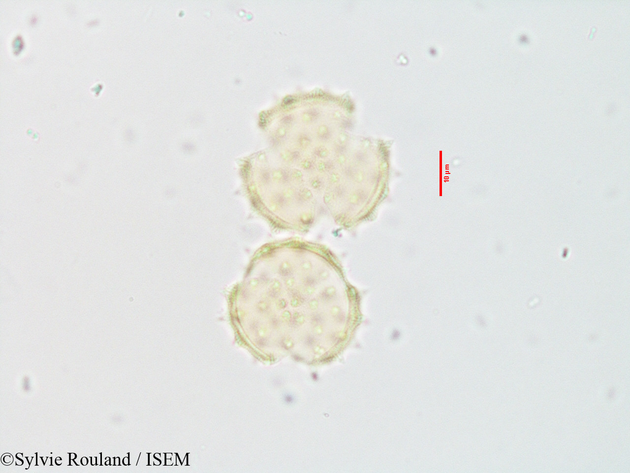 Sylvie.Rouland/Blepharispermum_zanguebaricum_3543/Blepharispermum_zanguebaricum_3543_0003(copy).jpg