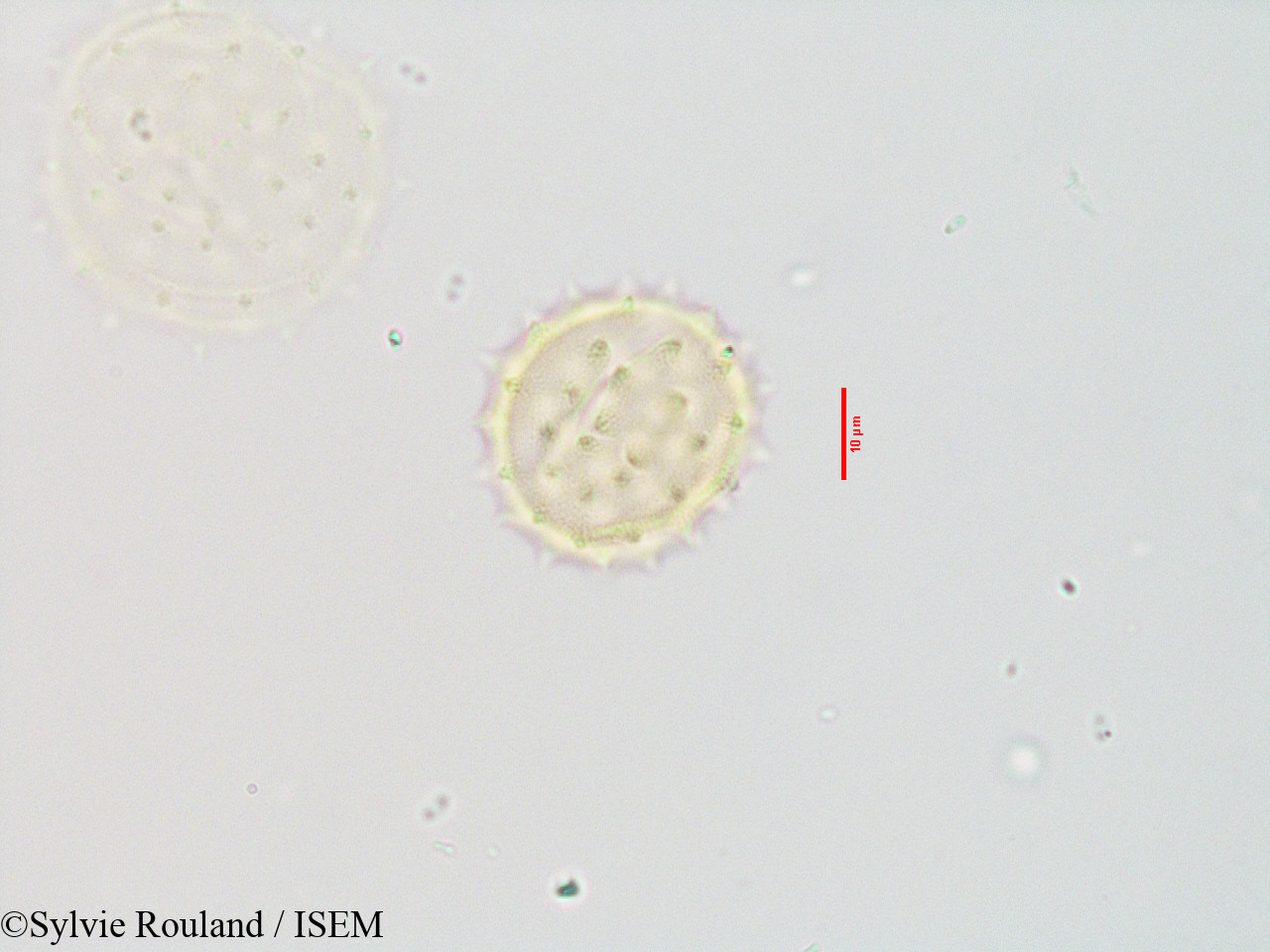 Sylvie.Rouland/Blepharispermum_zanguebaricum_3543/Blepharispermum_zanguebaricum_3543_0005(copy).jpg