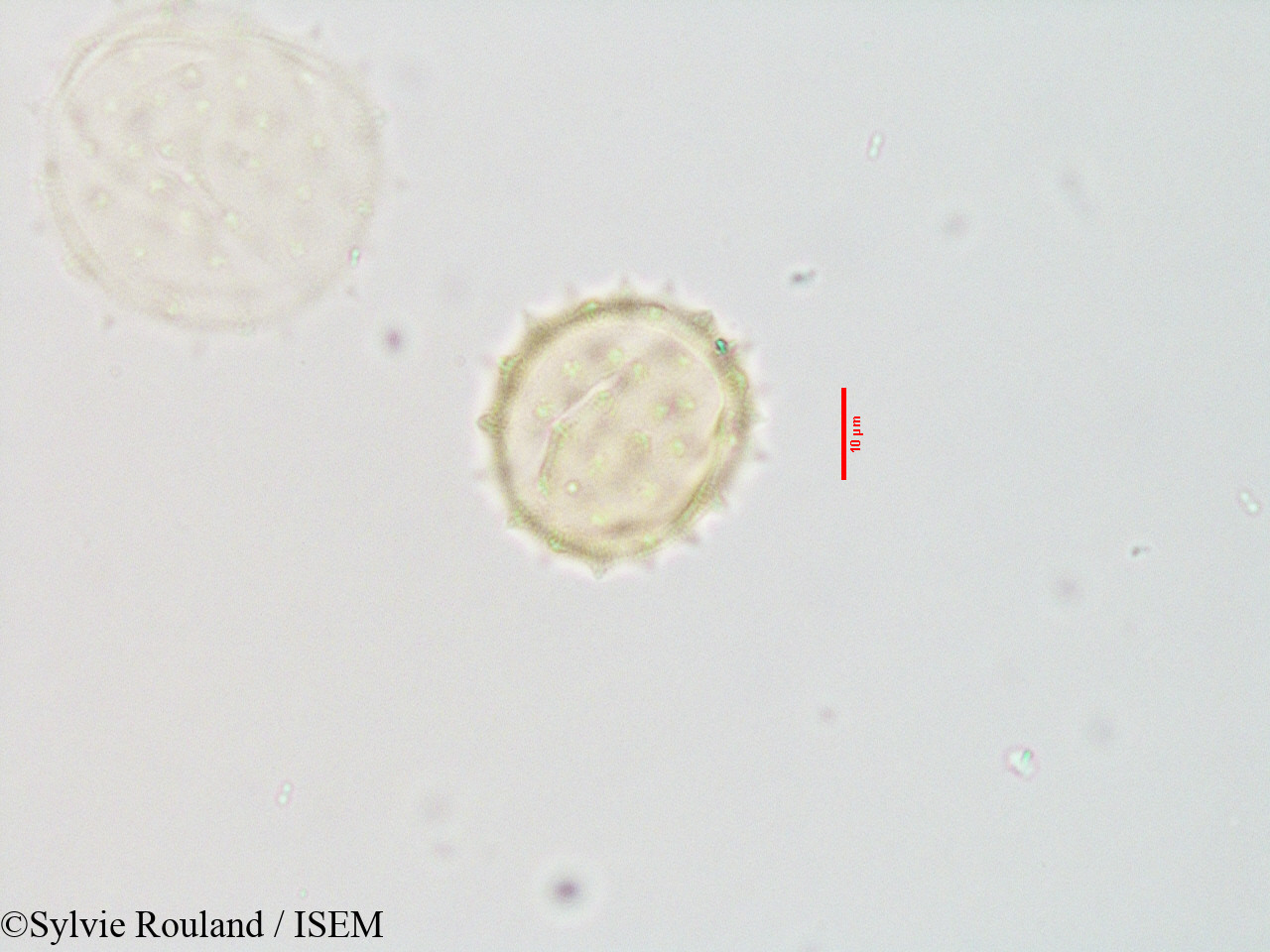 Sylvie.Rouland/Blepharispermum_zanguebaricum_3543/Blepharispermum_zanguebaricum_3543_0006(copy).jpg