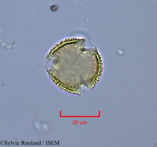 Sylvie.Rouland/Bridelia_tulasneana_1877/Bridelia_tulasneana_1877_0001(copy)_thumb.jpg