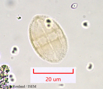 Sylvie.Rouland/Bupleurum_stellatum_934/Bupleurum_stellatum_934_0001(copy)_thumb.jpg