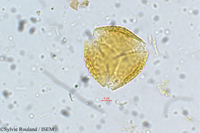 Sylvie.Rouland/Castanospermum_australe_5396/Castanospermum_australe_5396_0001(copy)_thumb.jpg